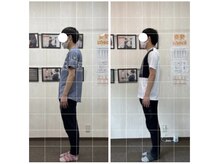 エモアメディカル整体院 麻布十番(Emoaメディカル整体院)/【30代男性】姿勢不良・頭痛