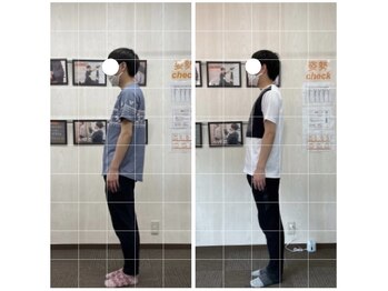 エモアメディカル整体院 麻布十番(Emoaメディカル整体院)/【30代男性】姿勢不良・頭痛