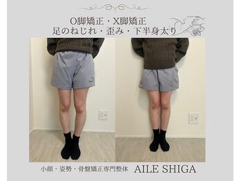 エール シガ(AILE SHIGA)/【O脚矯正】