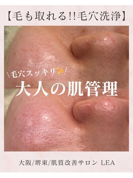 レア(Lea)/大人の肌管理＊
