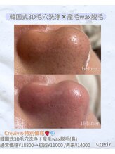 クレヴィー(Creviy)/New☆潤艶Wax脱毛(産毛脱毛)