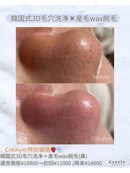 クレヴィー(Creviy)/New☆潤艶Wax脱毛(産毛脱毛)