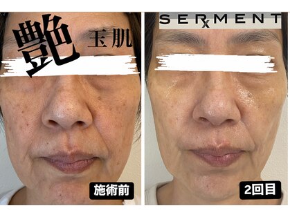 レア(Le'a)の写真