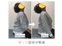 整体あゆむ 立川店/before after８