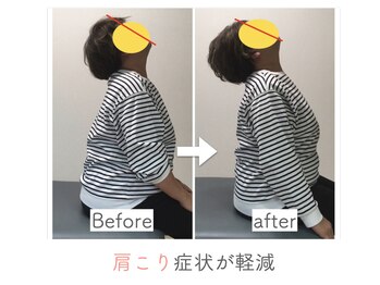整体あゆむ 立川店/before after８