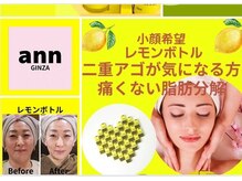 アン 銀座(ann)/レモンボトル