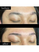 ユー 千葉駅前店(you)/症例写真