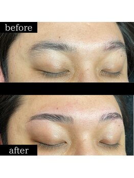 ユー 千葉駅前店(you)/症例写真