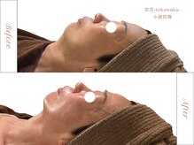 常若(tokowaka)の雰囲気（たるみ・むくみ・自律神経を土台から整える小顔管理｜高周波）