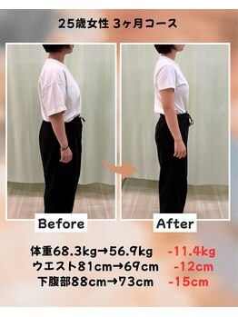 くさば整骨院/25歳女性/ダイエット3か月コース
