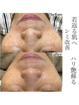 モンクラッシー(Mon classy)/