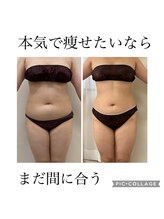 ラフレーズ 名駅店/【脂肪冷却】