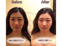 アジール 新潟市(agir)/Before/After画像