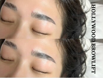 エルミュ(Elmu)/ハリウッドブロウリフト