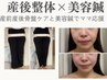 産後整体×美容鍼【産後骨盤/肩こり/腰痛】骨盤ケアと美容鍼で美容もケアも◎