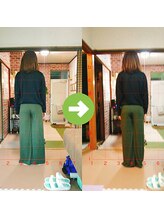 サプライズ整体院/20代ママさんの産後の骨盤初回