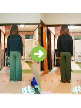 サプライズ整体院/20代ママさんの産後の骨盤初回