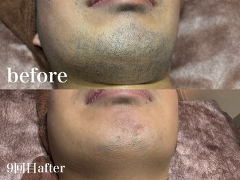 ディアーム 光明池店(Diarm)/