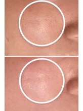 サロン リノ(salon rino)/AIリフトボニックス