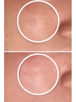 サロン リノ(salon rino)/AIリフトボニックス