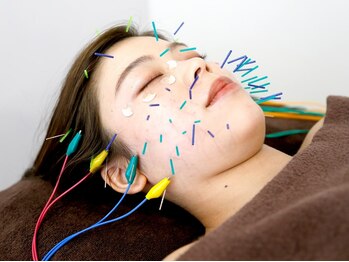 サプル(supple)の写真/<人気NO.1★"美容鍼"で顔が変わる!本気のリフトUP>真皮層に鍼で刺激を与えコラーゲン増幅!ふっくらハリ肌へ