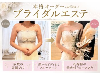 ナナイロ(nanairo)の写真/【多数の花嫁様実績】当店だけしかできない施術を。顔からボディまで超本格オーダーブライダルエステ。