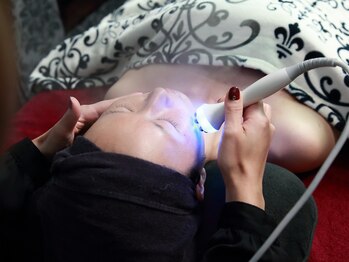 フルールドリス(fleur-de-lis)/エレクトロポレーション