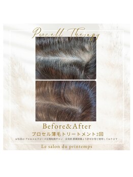 リラクシング スパ ハヤマ ブリーズ(Relaxing Spa Hayama Breeze)/プロセル頭皮改善