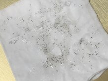 美容脱毛専門サロン エピラージュ 新宿店(Epilage)/照射後その場で抜けたヒゲです！