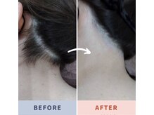 ルアナ(Luana)/全身脱毛12回コースのお客様☆