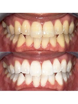 ライトビューティー 池袋店(LightBeauty)/症例写真