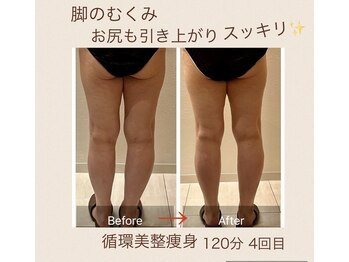 シェアサロンエムズ(share salon M's)/循環美整痩身