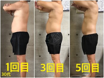 ペリー(PELLY)/男性30代 before after