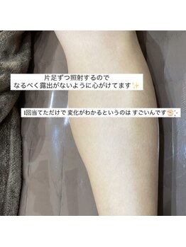 ルシェル(Le.ciel)/脚脱毛