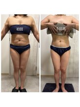 ラペ(la paix)/ボディ症例写真