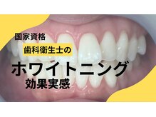 エルモ(elMo.)の雰囲気（エルモで驚くほど効果を実感していただけます★）