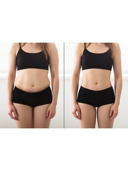 サイズダウンを目指したい