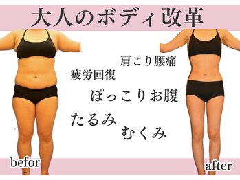 アルバ 広島店(ALBA)