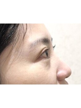 ボリュームのある目元にしたい