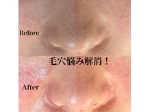 ビューティースタジオ ティー(Tiy)