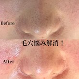 ビューティースタジオ ティー(Tiy)