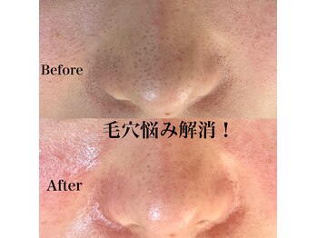 ビューティースタジオ ティー(Tiy)