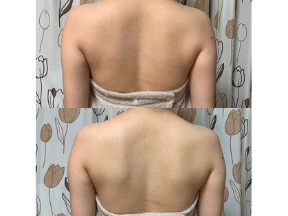 ソウビ(SowVi)の写真