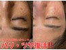 【シミ・くすみ集中】ハーブピーリングで透明肌♪ビタミンC＋ヒト幹導入
