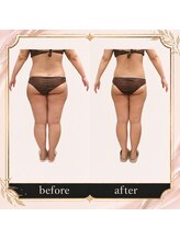 プロラボスパ 倉敷店/30代前半　症例写真
