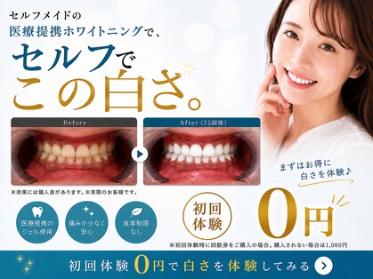 セルフメイド 宇部本店(SELFMADE)の写真