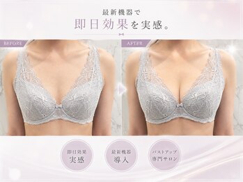 ミモア ローズ(Mimore Roze)の写真/<ふっくら魅力的なシルエットへ>最新機器と熟練ハンドで当日から効果実感☆専用クリームで脂肪増加効果も♪