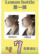 アローナ(ARONA)/レモンボトルで半永久的に溶解！