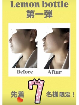 アローナ(ARONA)/レモンボトルで半永久的に溶解！