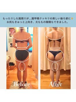 エルバード/肩甲骨クッキリの美しい後ろ姿！